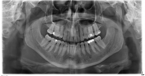 Dental X-rays…why are they important?