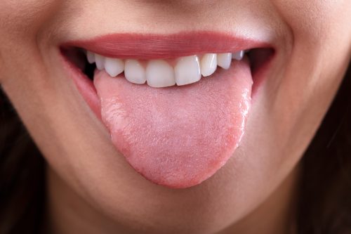 What can your tongue say about your health?